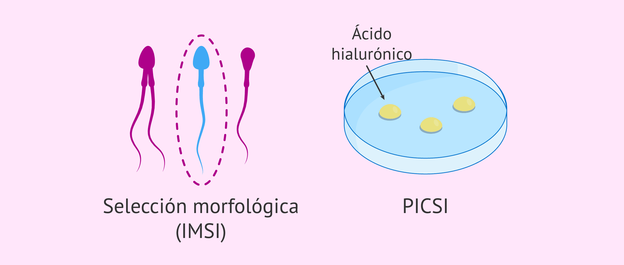 Ejemplo de Imagen informativa