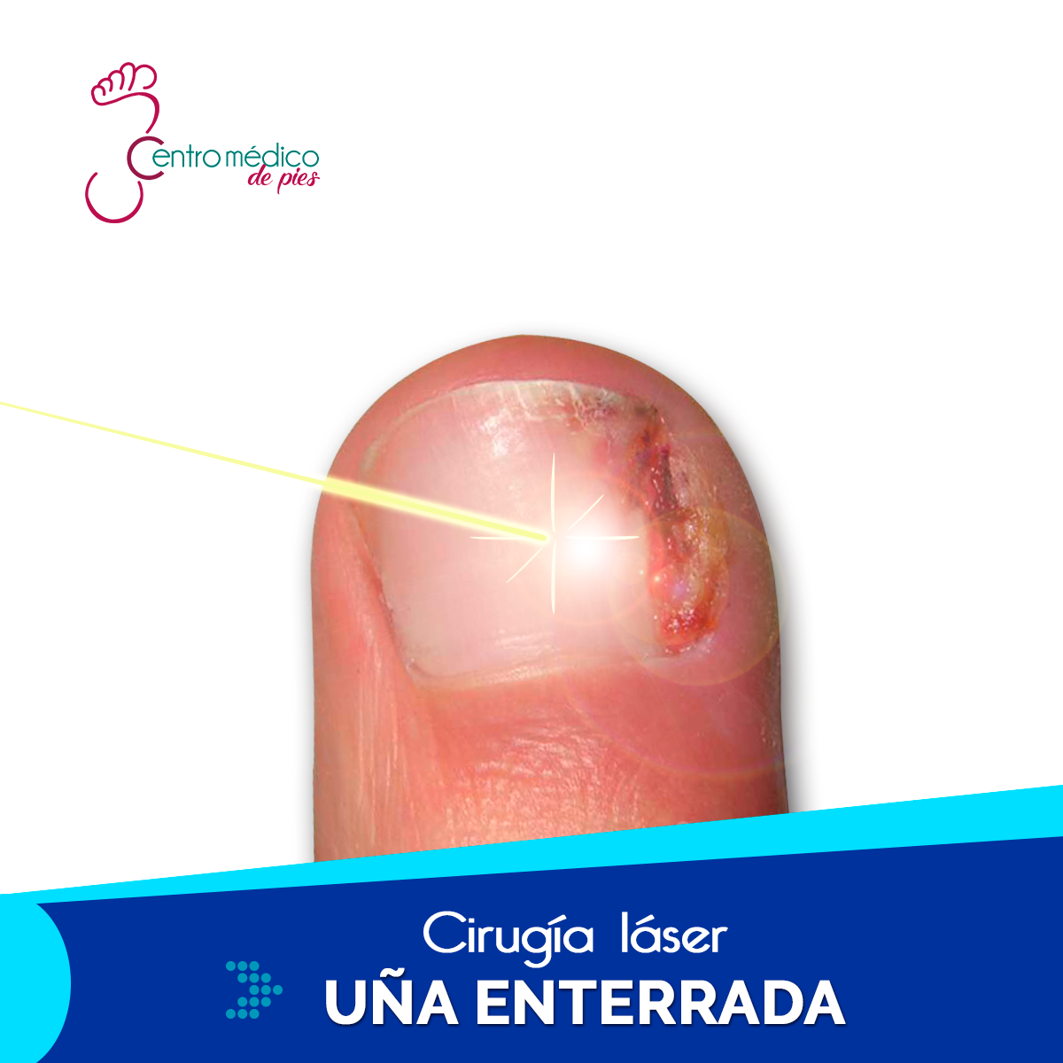 Ejemplo de Imagen informativa