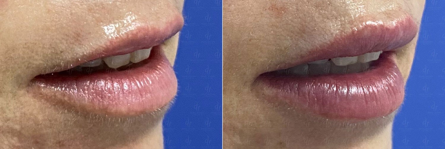 Ejemplo de Imagen informativa 8