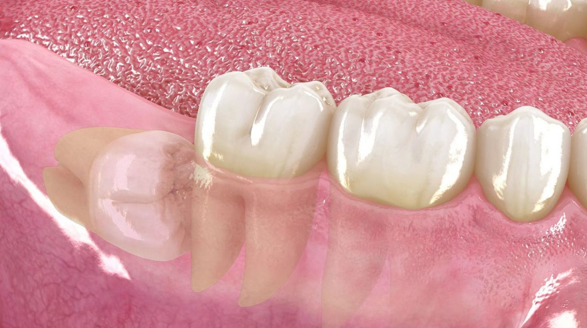 Ejemplo de Imagen informativa 8