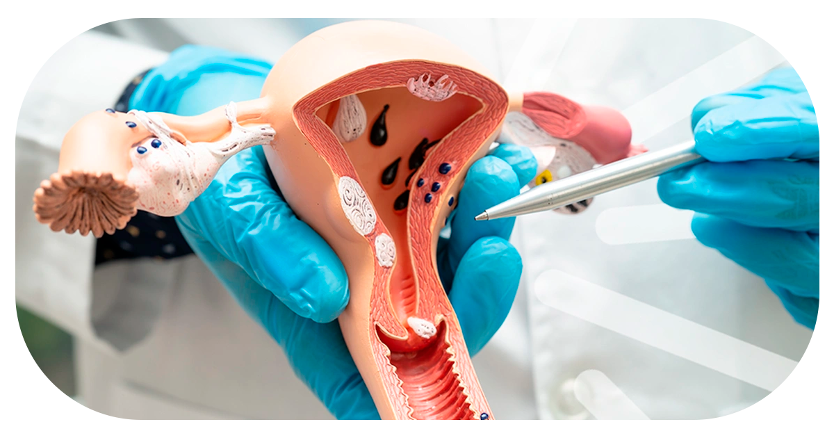 Ejemplo de Imagen Aqui