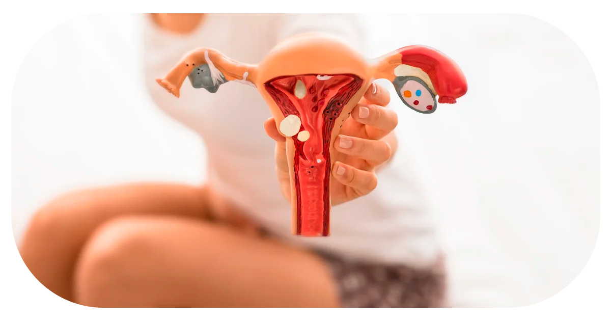 Ejemplo de Imagen Aqui