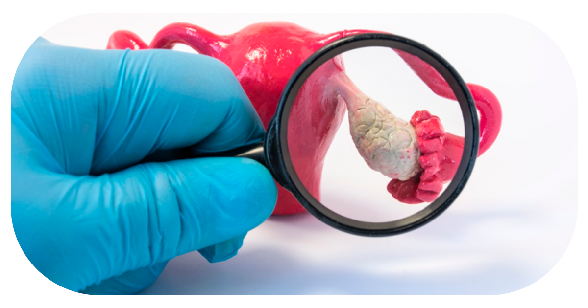 Ejemplo de Imagen Aqui