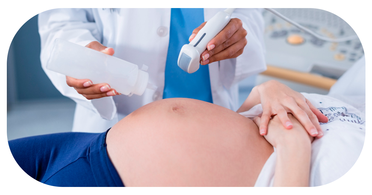 Ejemplo de Imagen Aqui