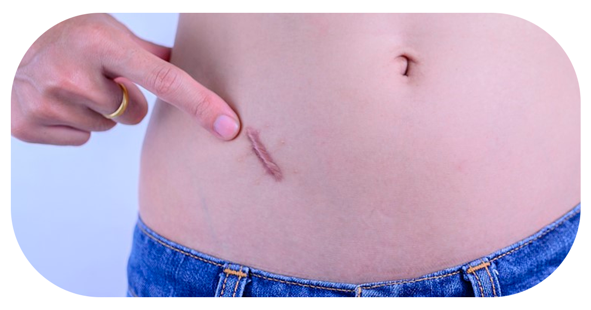 Ejemplo de Imagen Aqui