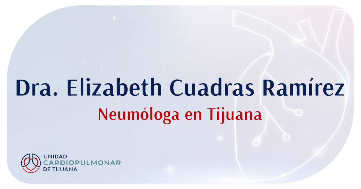 Ejemplo de Imagen Aqui