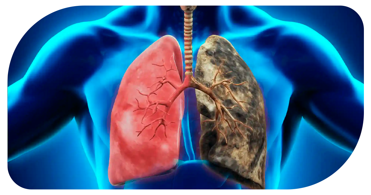 Ejemplo de Imagen informativa 2