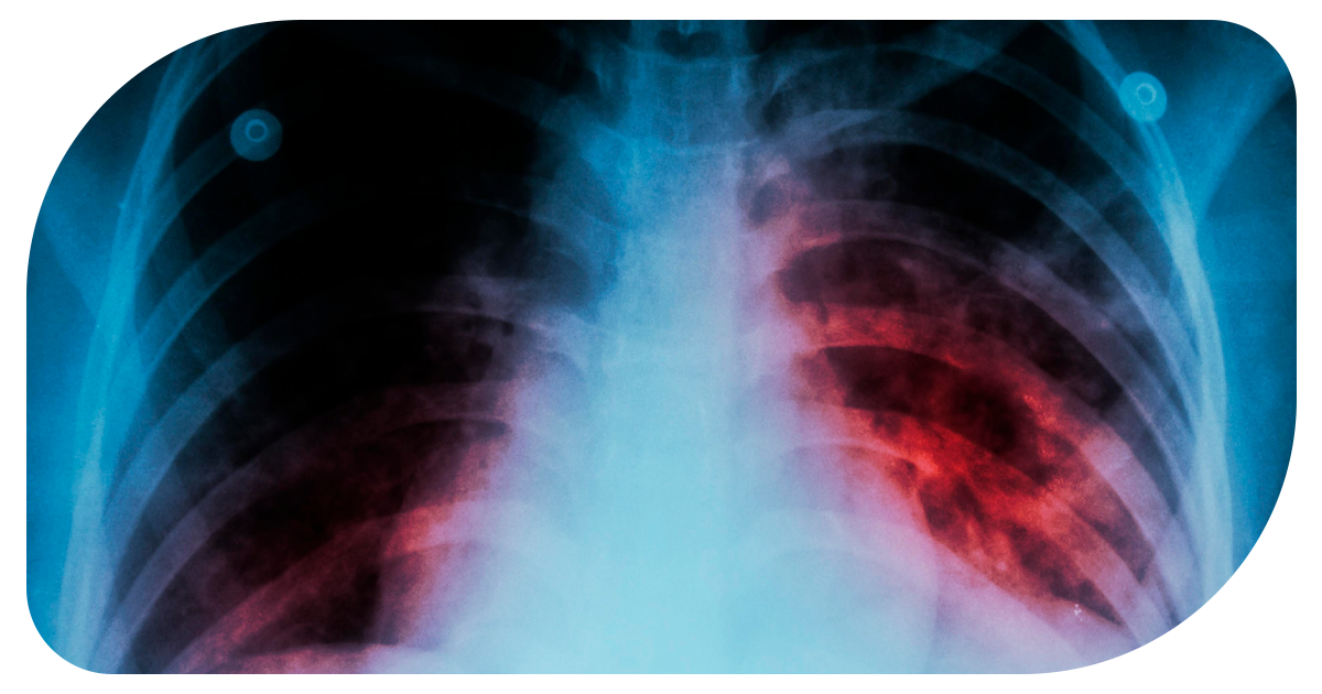 Ejemplo de Imagen informativa 4