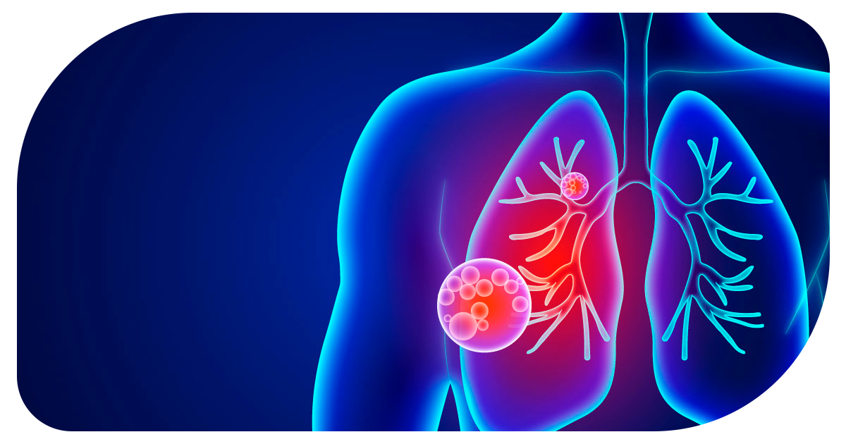 Ejemplo de Imagen informativa 6