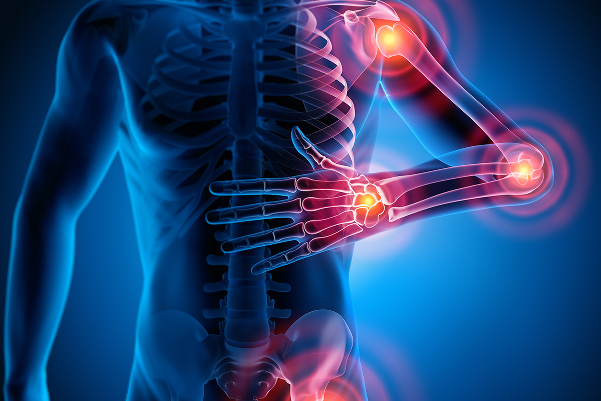 Ejemplo de Imagen informativa