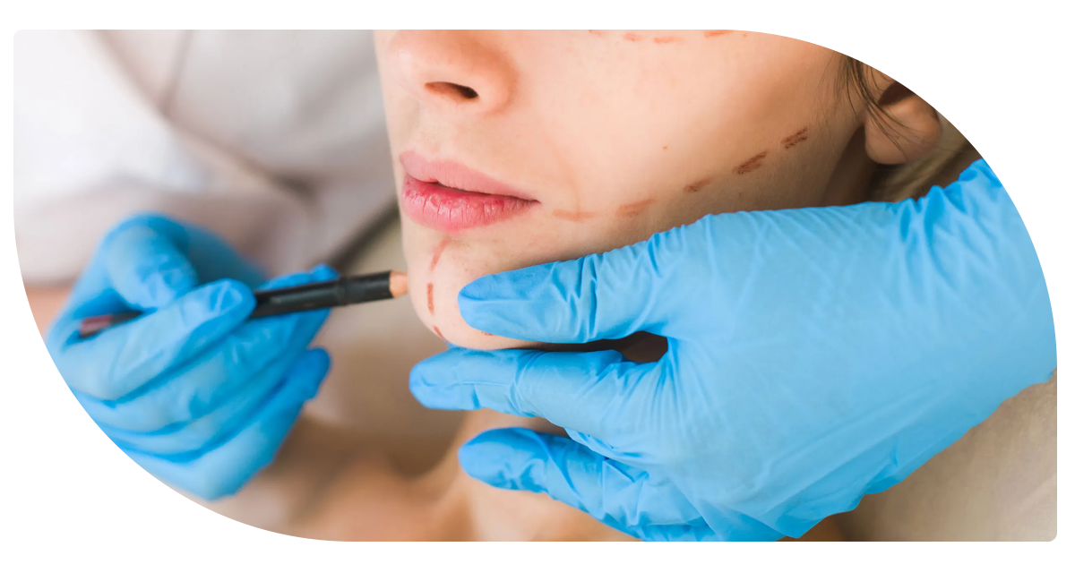 Ejemplo de Imagen Aqui