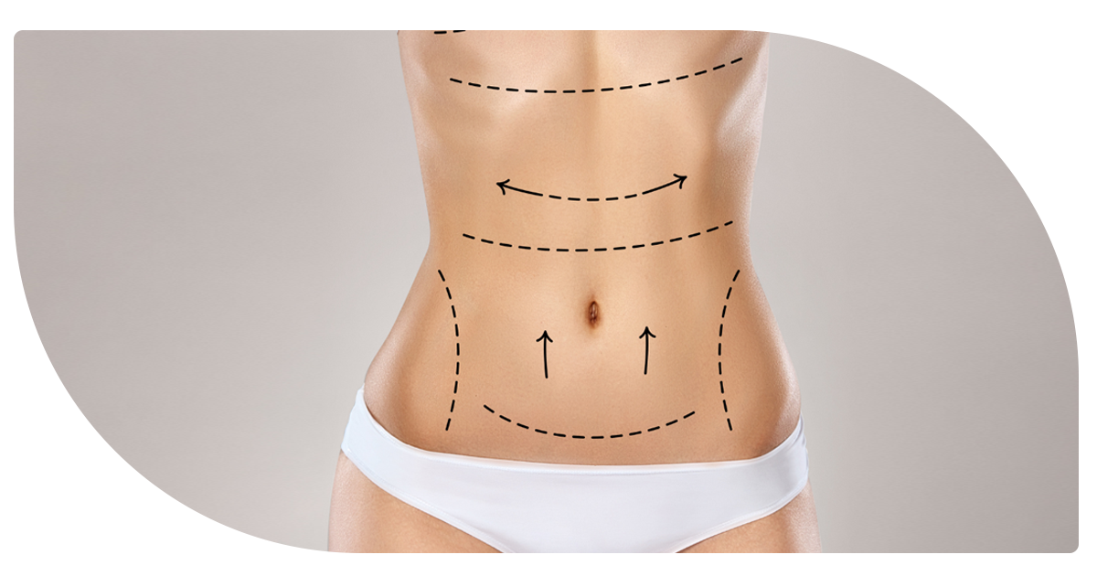 Ejemplo de Imagen Aqui