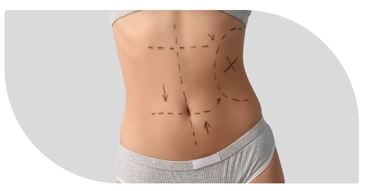 Ejemplo de Imagen Aqui