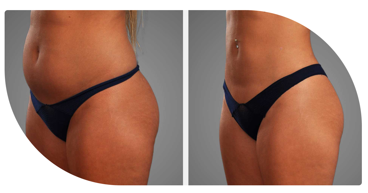 Ejemplo de Imagen Aqui