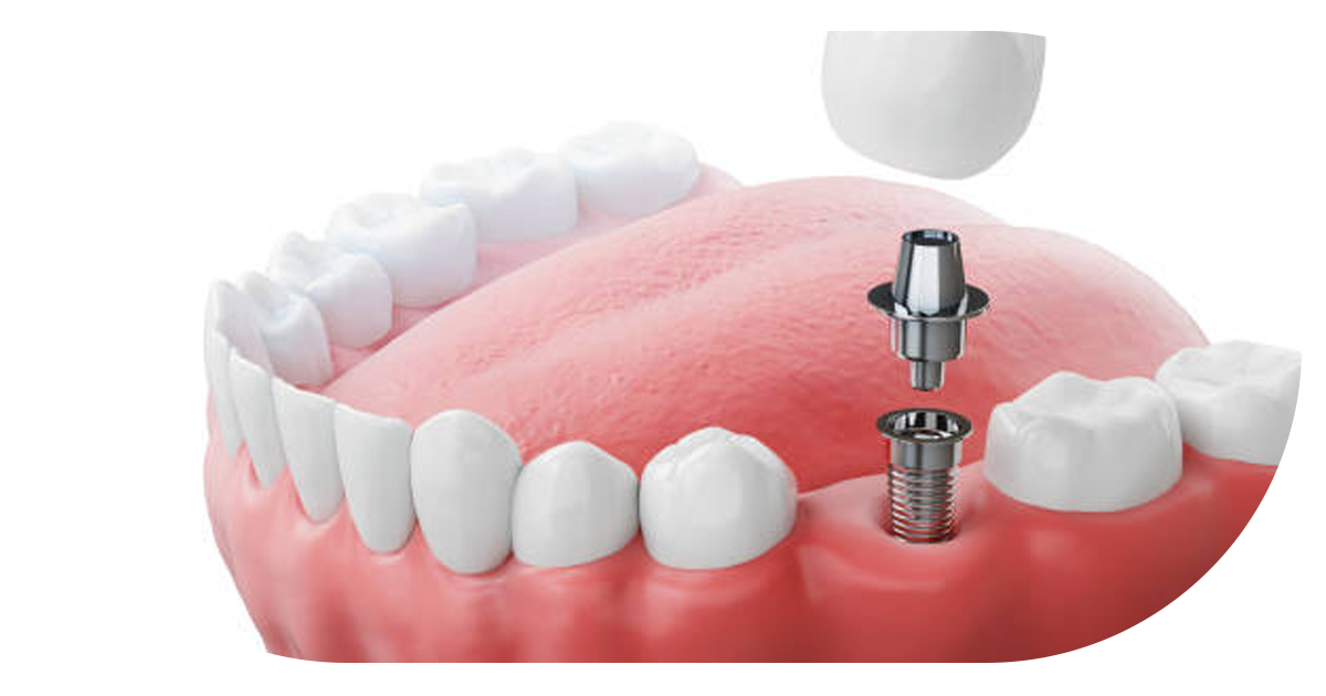 Ejemplo de Imagen Aqui