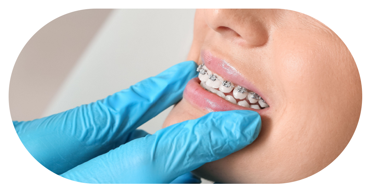 Ejemplo de Imagen Aqui