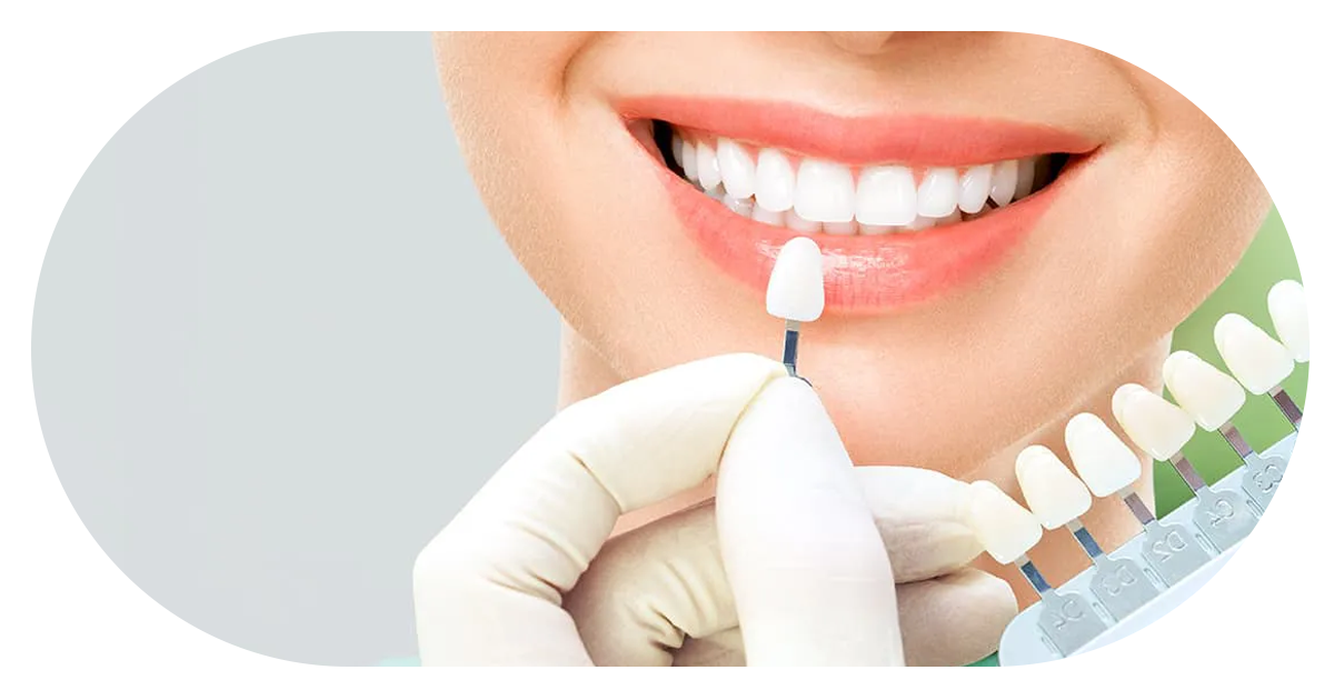 Ejemplo de Imagen Aqui