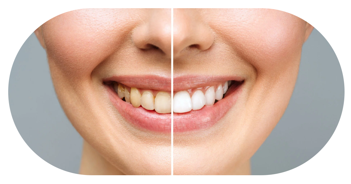 Ejemplo de Imagen Aqui