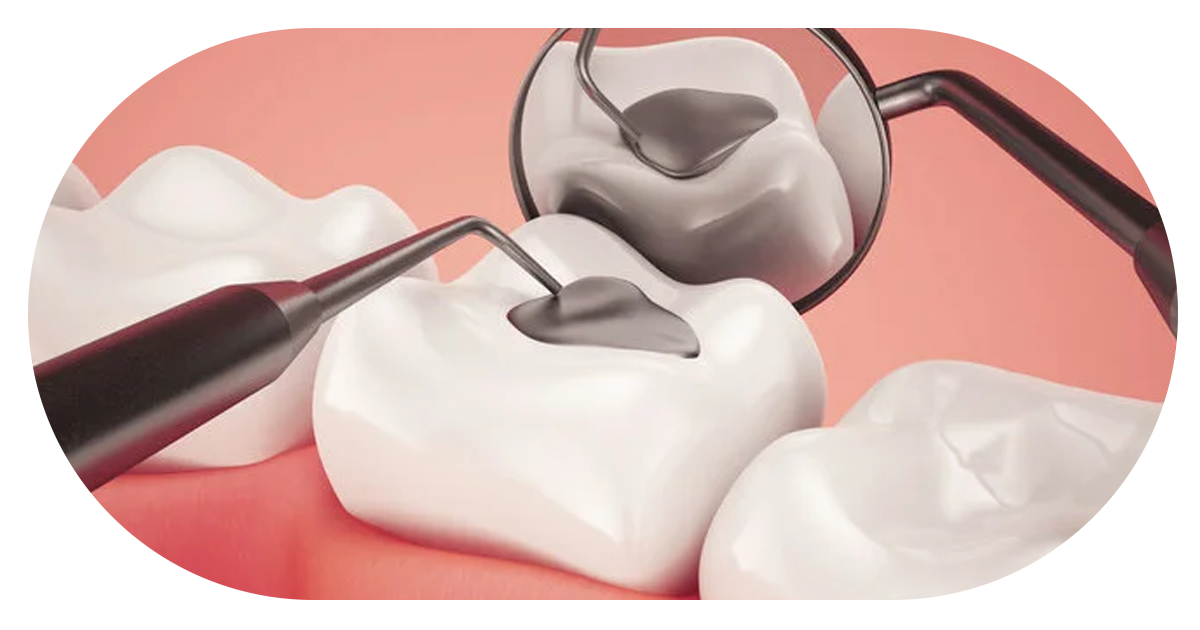 Ejemplo de Imagen Aqui