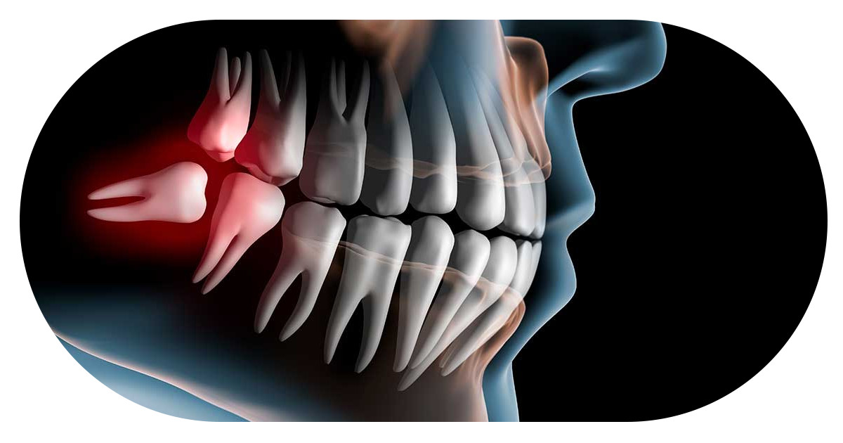 Ejemplo de Imagen Aqui