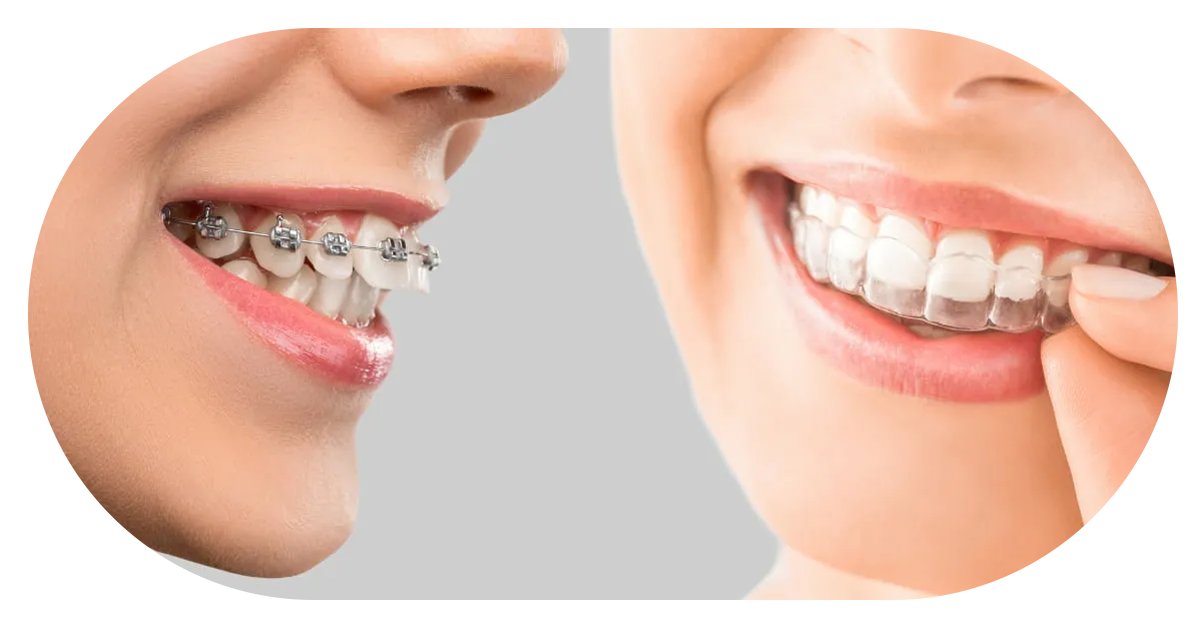 Ejemplo de Imagen Aqui