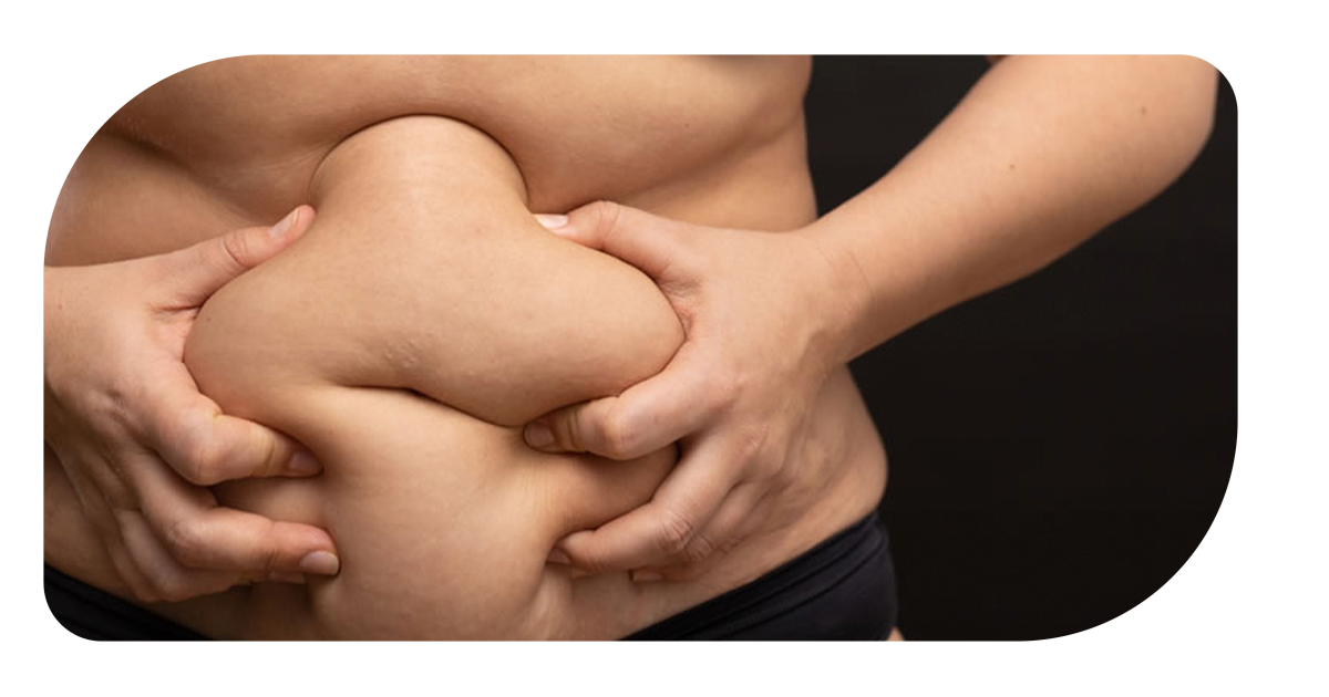 Ejemplo de Imagen informativa