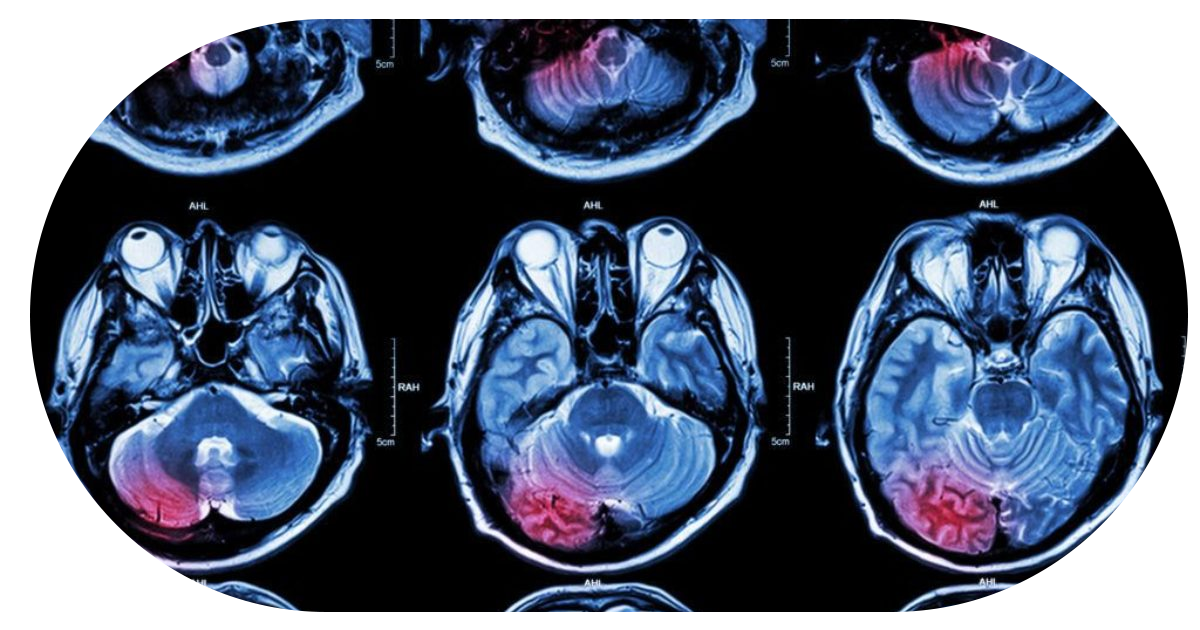 Ejemplo de Imagen Aqui