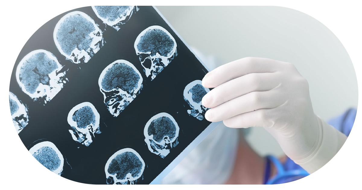 Ejemplo de Imagen Aqui