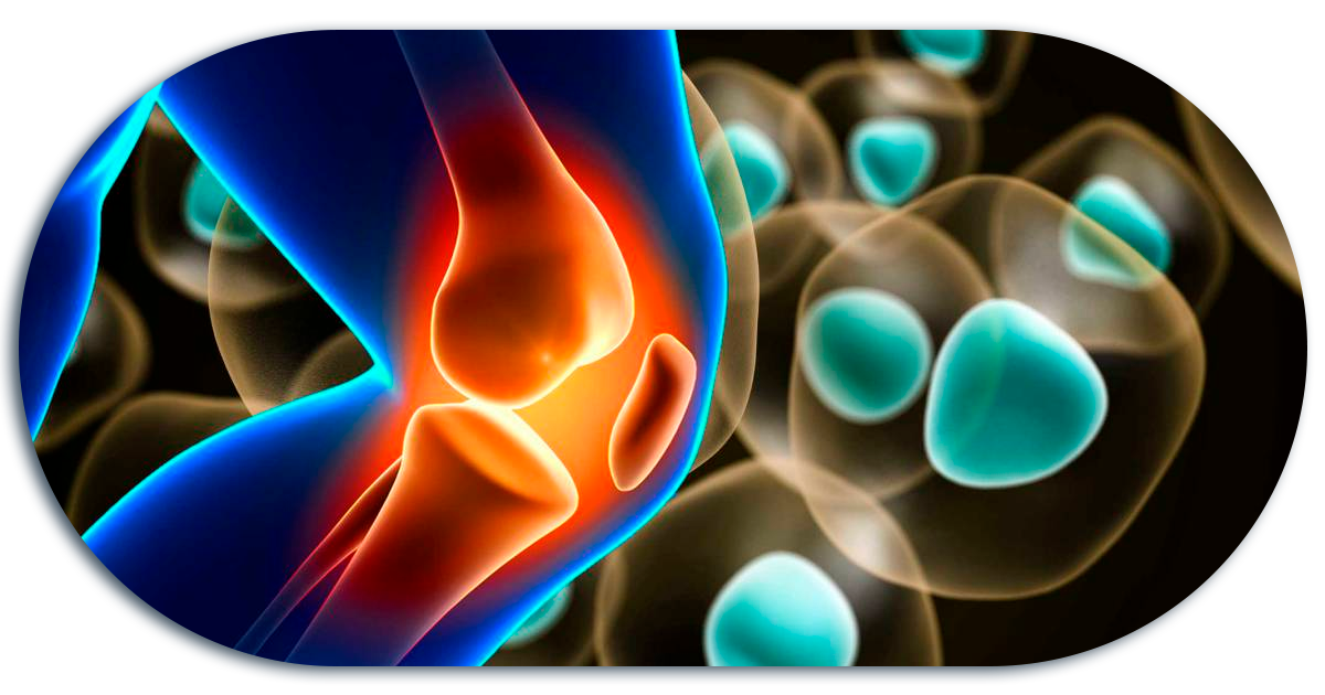 Ejemplo de Imagen informativa 5