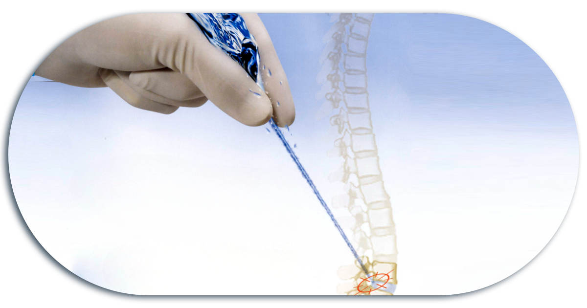 Ejemplo de Imagen informativa 5