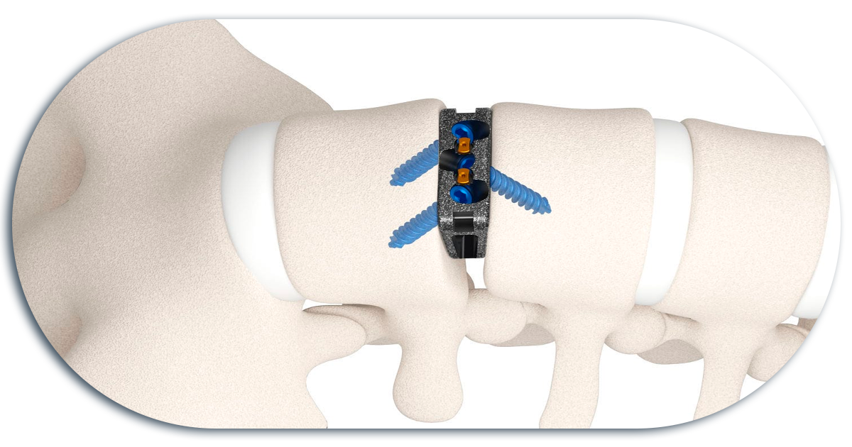 Ejemplo de Imagen informativa