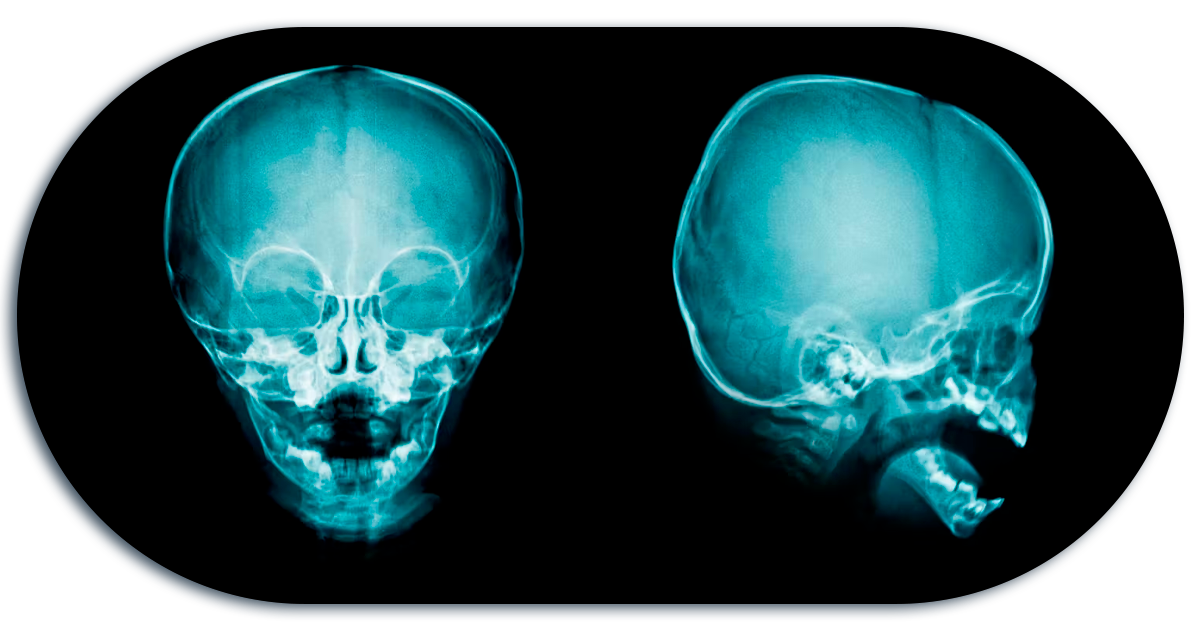 Ejemplo de Imagen informativa 7
