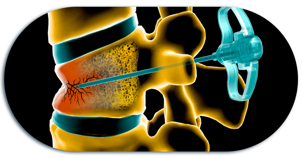 Ejemplo de Imagen informativa