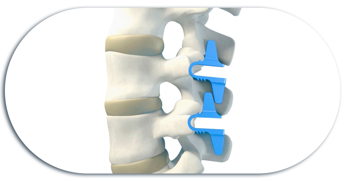 Ejemplo de Imagen informativa 3