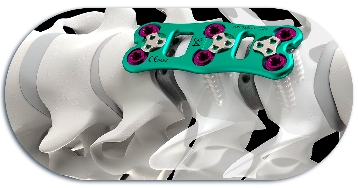 Ejemplo de Imagen informativa 2