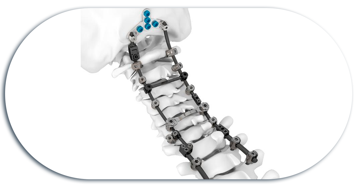 Ejemplo de Imagen informativa 4