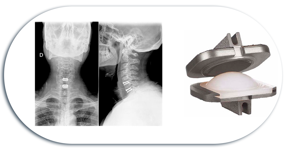 Ejemplo de Imagen informativa 5