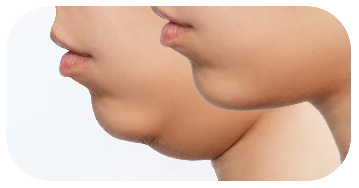 Ejemplo de Imagen Aqui