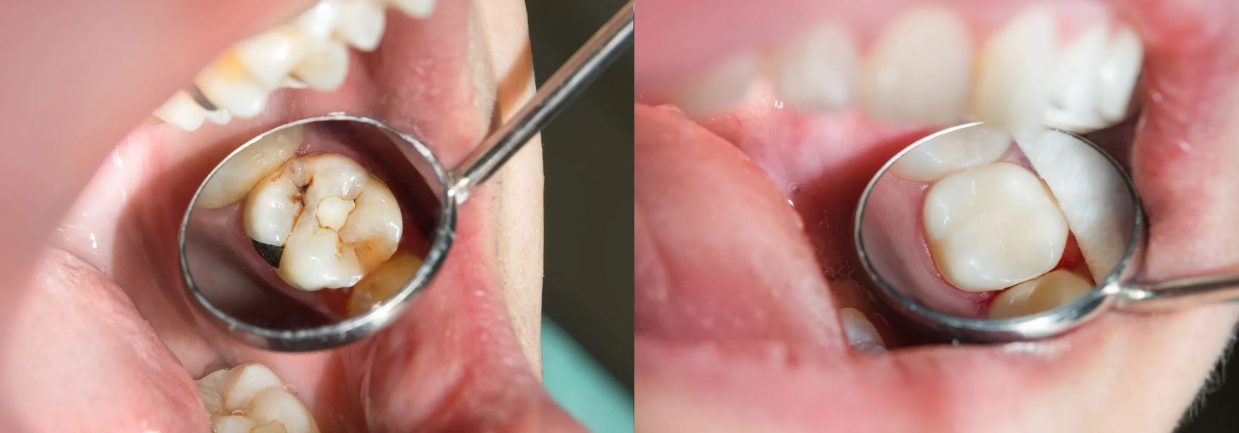 Ejemplo de Imagen informativa