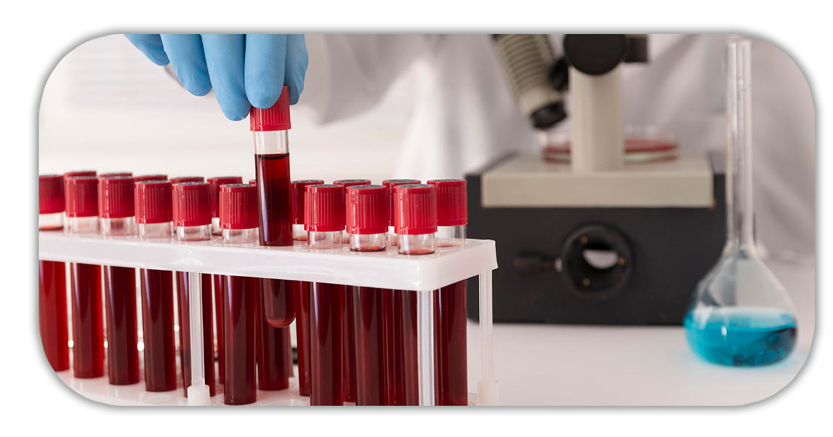 Ejemplo de Imagen informativa