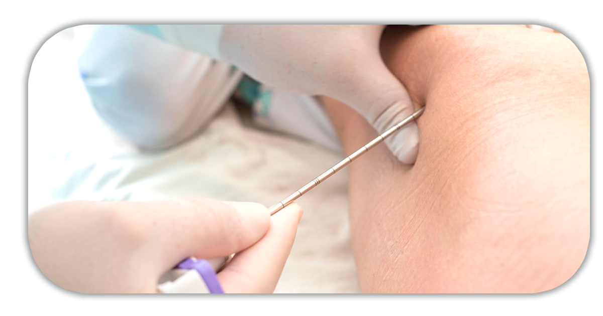 Ejemplo de Imagen informativa 6