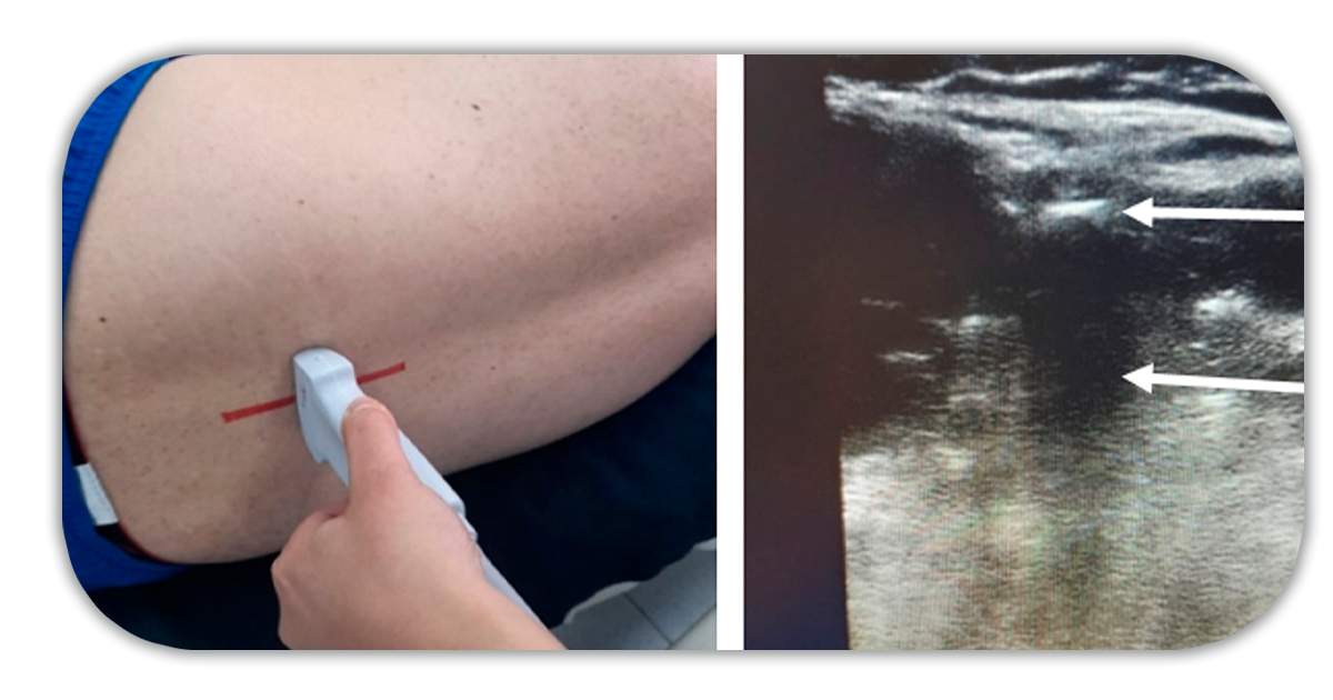 Ejemplo de Imagen informativa 7