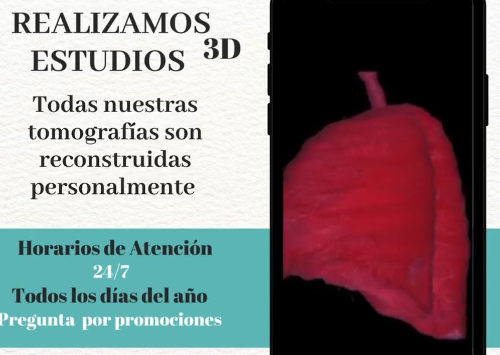 Ejemplo de Imagen informativa