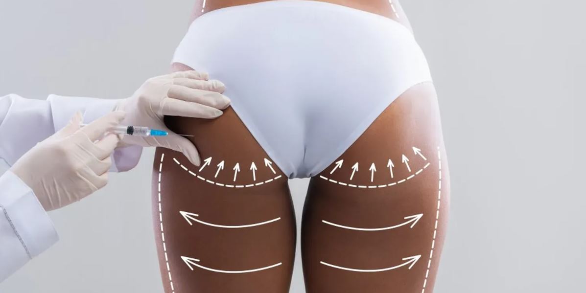 Ejemplo de Imagen informativa