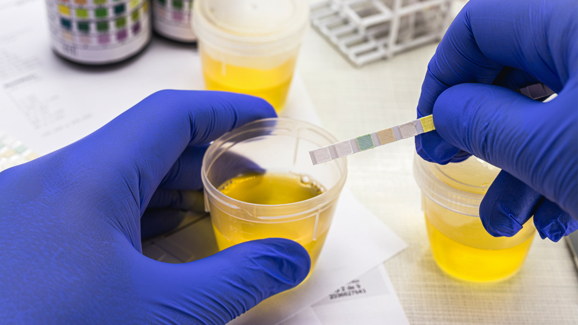 Ejemplo de Imagen informativa 7