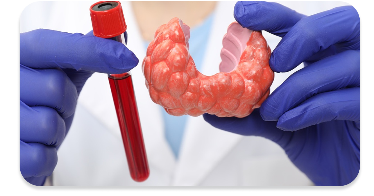 Ejemplo de Imagen informativa