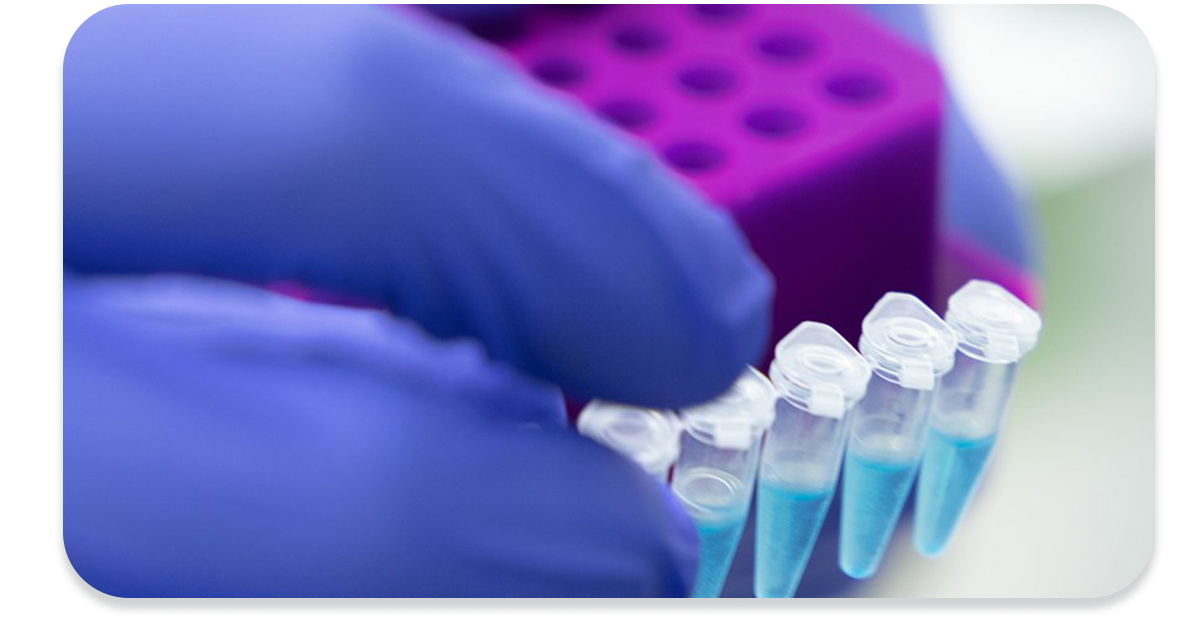 Ejemplo de Imagen informativa