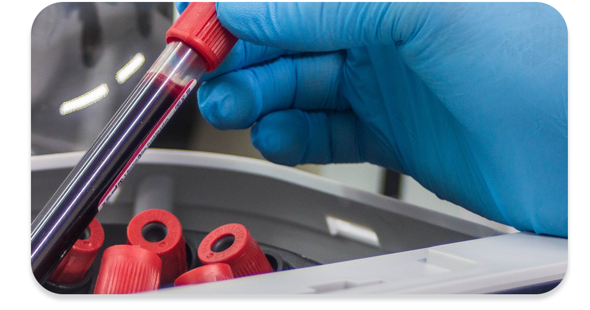 Ejemplo de Imagen informativa