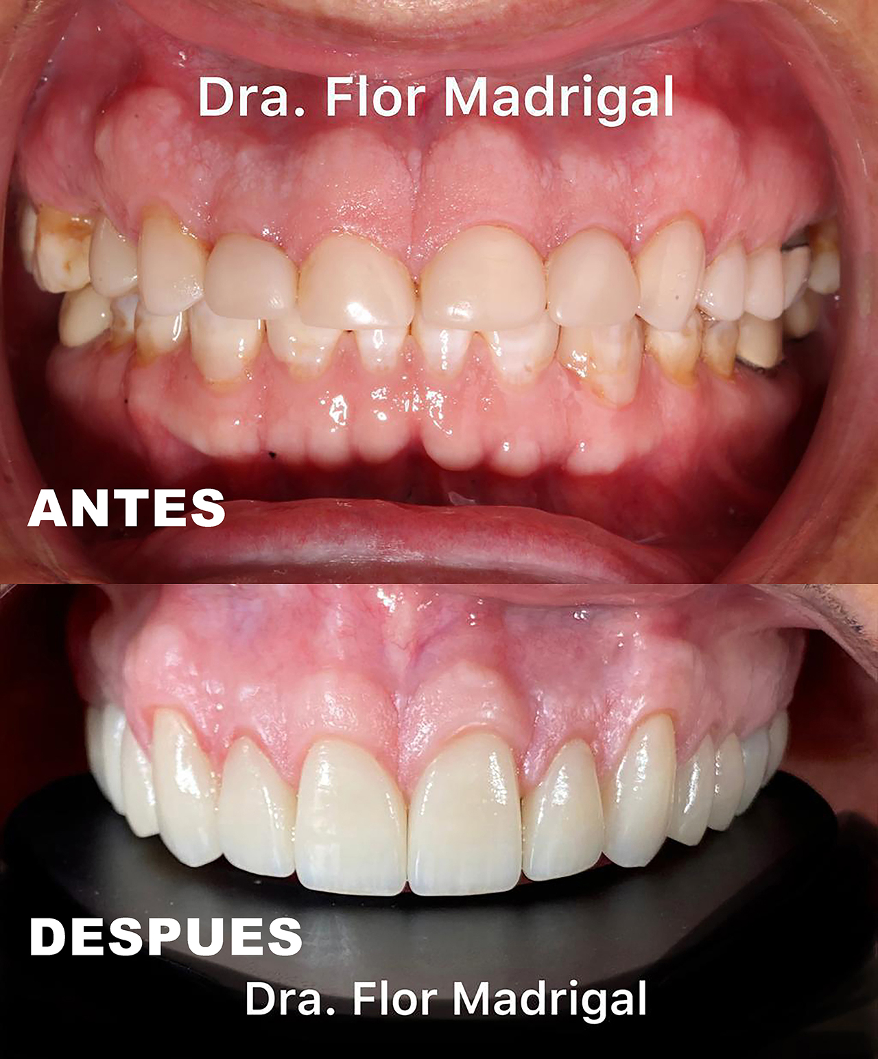 Ejemplo de Imagen informativa 2