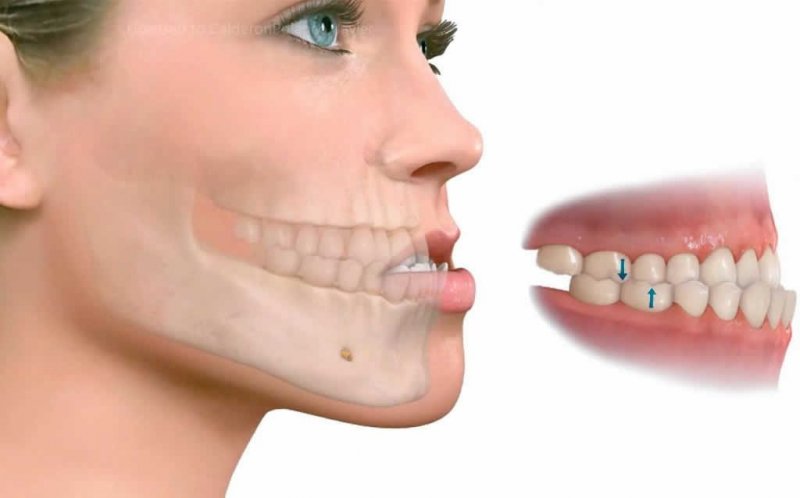 Ejemplo de Imagen informativa 6